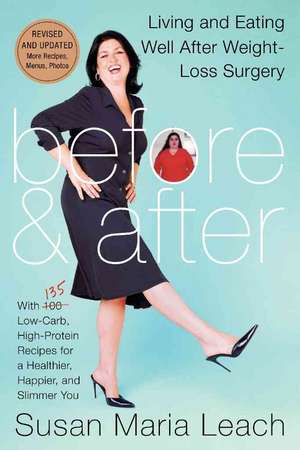 Before & After: Living and Eating Well After Weight-Loss Surgery de Susan Maria Leach