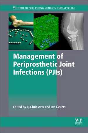 Management of Periprosthetic Joint Infections (PJIs) de J.J. Chris Arts