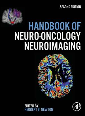 Handbook of Neuro-Oncology Neuroimaging de Herbert B. Newton