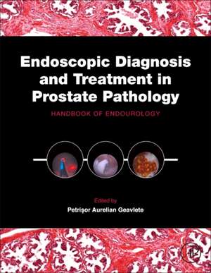 Endoscopic Diagnosis and Treatment in Prostate Pathology: Handbook of Endourology de Petrisor Aurelian Geavlete