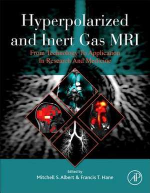 Hyperpolarized and Inert Gas MRI: From Technology to Application in Research and Medicine de Mitchell S. Albert