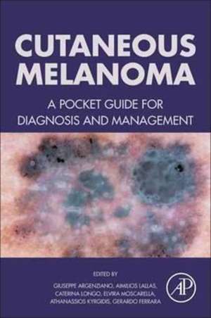 Cutaneous Melanoma: A Pocket Guide for Diagnosis and Management de Giuseppe Argenziano