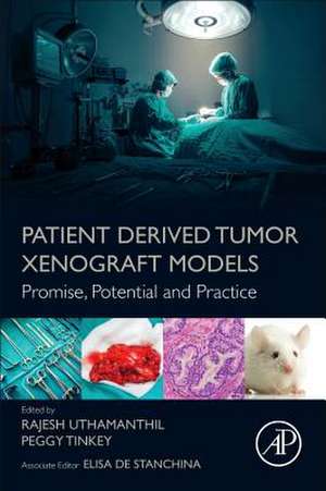 Patient Derived Tumor Xenograft Models: Promise, Potential and Practice de Rajesh Uthamanthil