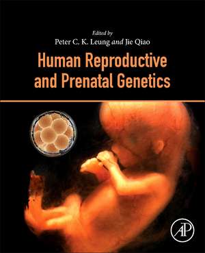 Human Reproductive and Prenatal Genetics de Peter C.K. Leung