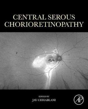 Central Serous Chorioretinopathy de Jay Chhablani