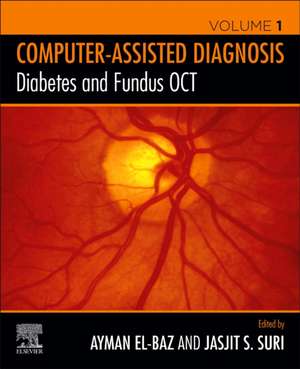 Diabetes and Fundus OCT de Ayman S. El-Baz