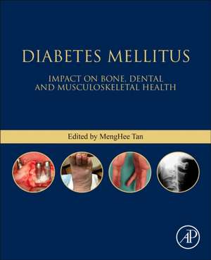 Diabetes Mellitus: Impact on Bone, Dental and Musculoskeletal Health de Meng Hee Tan