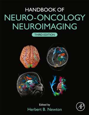 Handbook of Neuro-Oncology Neuroimaging de Herbert B. Newton