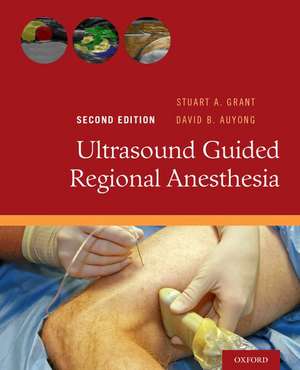 Ultrasound Guided Regional Anesthesia de Stuart A. Grant