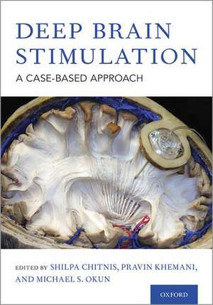 Deep Brain Stimulation: A Case-based Approach de Shilpa Chitnis