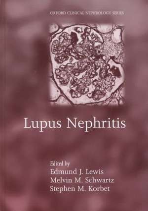 Lupus Nephritis de Edmund J. Lewis