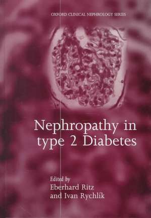 Nephropathy in Type 2 Diabetes de Eberhard Ritz