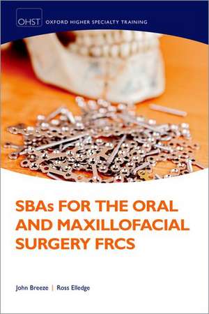 SBAs for the Oral and Maxillofacial Surgery FRCS de John Breeze