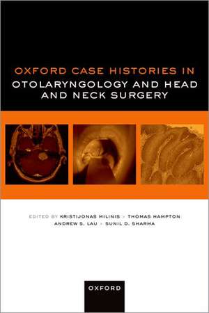 Oxford Case Histories in Otolaryngology and Head and Neck Surgery de Kristijonas Milinis