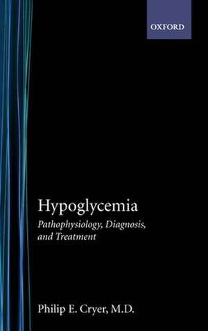 Hypoglycemia: Pathophysiology, Diagnosis, and Treatment de Philip E. Cryer