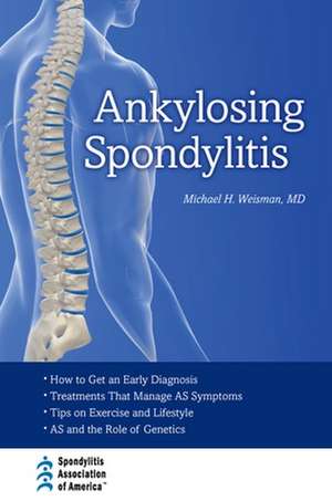 Ankylosing Spondylitis de Michael H. Weisman