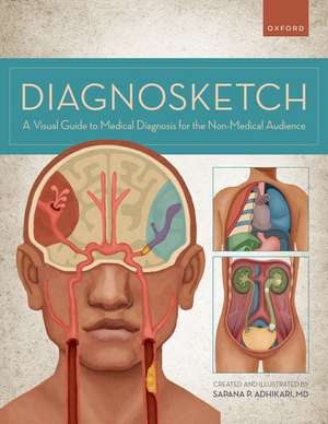 Diagnosketch: A Visual Guide to Medical Diagnosis for the Non-Medical Audience de Sapana Adhikari