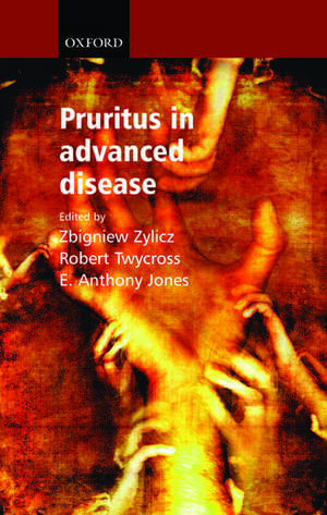 Pruritus in Advanced Disease de Zbigniew Zylicz