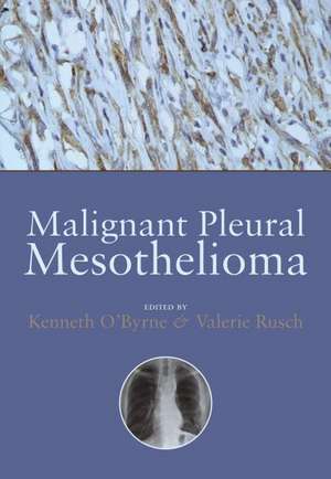 Malignant Pleural Mesothelioma de Kenneth O'Byrne