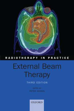 External Beam Therapy de Peter Hoskin