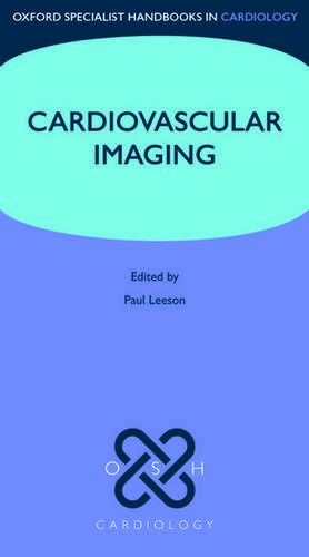 Cardiovascular Imaging de Paul Leeson