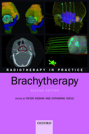 Radiotherapy in Practice - Brachytherapy de Peter Hoskin