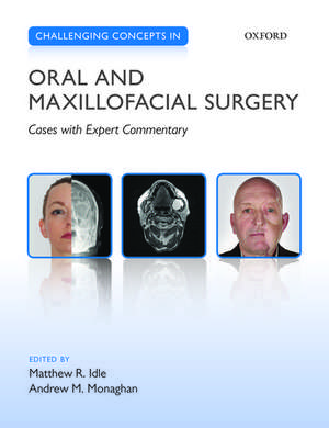 Challenging Concepts in Oral and Maxillofacial Surgery: Cases with Expert Commentary de Matthew R. Idle