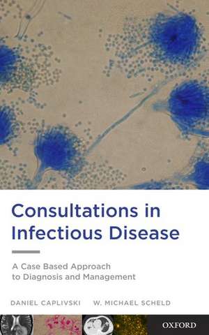 Consultations in Infectious Disease: A Case Based Approach to Diagnosis and Management de Daniel Caplivski