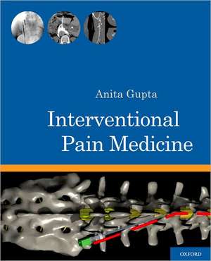 Interventional Pain Medicine de Anita Gupta