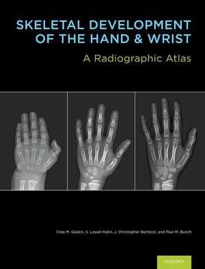 Skeletal Development of the Hand and Wrist: A Radiographic Atlas and Digital Bone Age Companion de Cree M. Gaskin