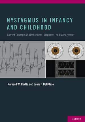 Nystagmus In Infancy and Childhood: Current Concepts in Mechanisms, Diagnoses, and Management de Richard W. Hertle