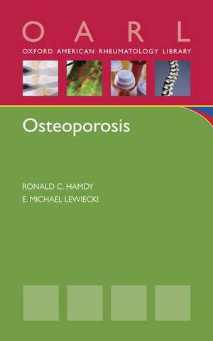 Osteoporosis de Ronald C. Hamdy