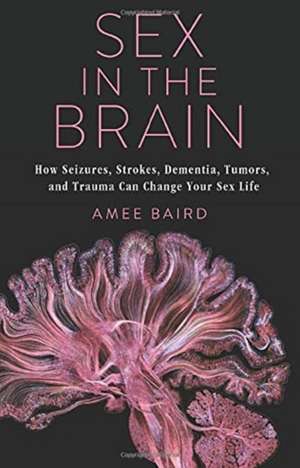 Sex in the Brain – How Seizures, Strokes, Dementia, Tumors, and Trauma Can Change Your Sex Life de Amee Baird