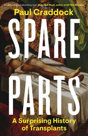 Spare Parts: A Surprising History of Transplants de Paul Craddock