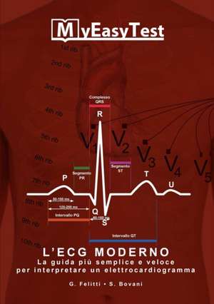 L'ECG Moderno - MyEasyTest (edizione economica) de Giuseppe Felitti