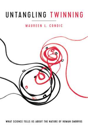 Untangling Twinning de Maureen L. Condic