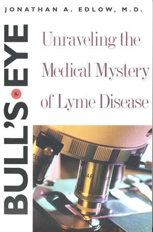 Bull’s-Eye: Unraveling the Medical Mystery of Lyme Disease, Second Edition de Jonathan A. Edlow