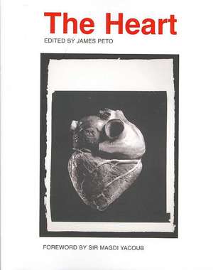 The Heart de James Peto