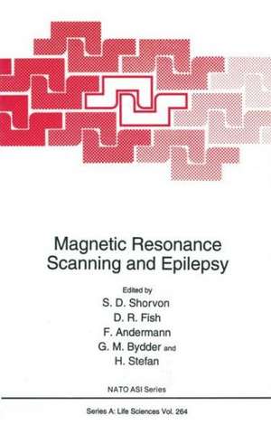 Magnetic Resonance Scanning and Epilepsy de Shorvon