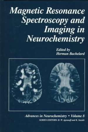 Magnetic Resonance Spectroscopy and Imaging in Neurochemistry de H. S. Bachelard