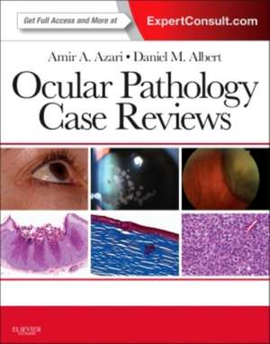 Ocular Pathology Case Reviews: Expert Consult - Online and Print de Amir A. Azari