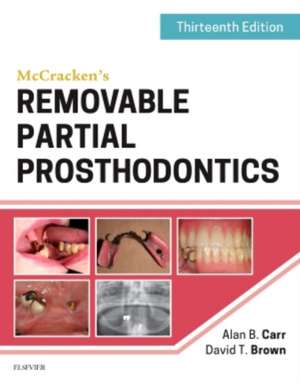 McCracken's Removable Partial Prosthodontics de Alan B. Carr