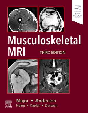 Musculoskeletal MRI de Nancy M. Major