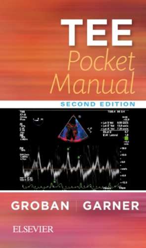 TEE Pocket Manual de Leanne Groban