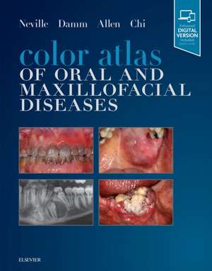 Color Atlas of Oral and Maxillofacial Diseases de Brad W. Neville