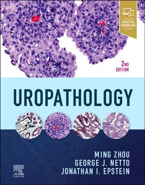 Uropathology de Ming Zhou