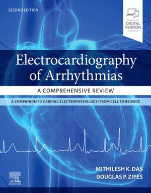 Electrocardiography of Arrhythmias: A Comprehensive Review de Mithilesh Kumar Das