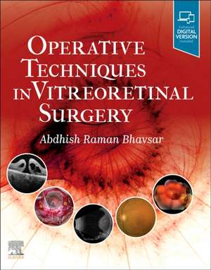 Operative Techniques in Vitreoretinal Surgery de Abdhish R. Bhavsar