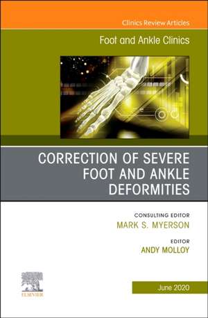 Correction of Severe Foot and Ankle Deformities, An issue of Foot and Ankle Clinics of North America de Andy Molloy