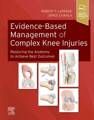 Evidence-Based Management of Complex Knee Injuries: Restoring the Anatomy to Achieve Best Outcomes de Robert F. LaPrade